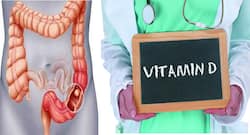 Vitamin D May Protect Against Colorectal Cancer: Best Dietary Sources Of The Sunshine Vitamin