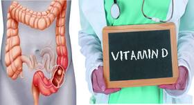 Vitamin D May Protect Against Colorectal Cancer: Best Dietary Sources Of The Sunshine Vitamin
