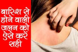 Home remedies for Itching: बारिश में भीगने के बाद हाथ-पैरों में खुजली और जलन हो रही है? ट्राई करें ये घरेलू नुस्‍खे, तुरंत मिलेगा आराम