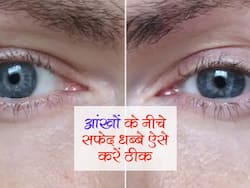 आंखों के नीचे चिकन स्किन से परेशान? डॉक्टर के बताए ये 10 टिप्स दिलाएंगे मुर्गे जैसी स्किन से निजात