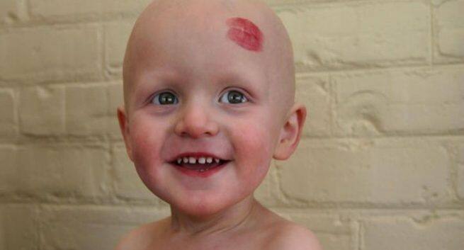 cancer-in-kids and covid-19 infection