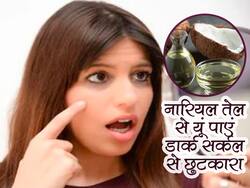नारियल तेल में मिलाएं ये 2 चीजें और पाएं डार्क सर्कल से छुटकारा