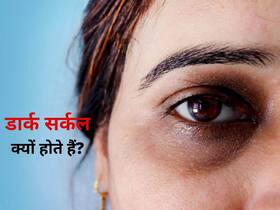 Dark Circles Under The Eyes: डार्क सर्कल 3 तरह के होते हैं, एक्सपर्ट से जानिए इनके कारण, लक्षण और बचाव