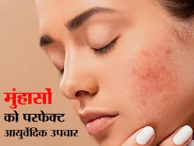 मुंहासों के लिए ढूंढ रहे परफेक्ट घरेलू उपचार? न हों परेशान अब एक्सपर्ट का ये नुस्खा देगा क्लीयर स्किन
