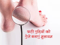 फटी एड़ियों से कभी नहीं निकलेगा खून अगर घर पर कर लेंगे ये 10 काम, पुरुष हों या महिलाएं दोनों ही आजमाएं