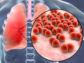 Be Careful Of Short-Lived Lung Infections; May Increase The Risk Of Long-Term Lung Damage