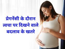 Pregnancy Skin Changes: प्रेगनेंसी के दौरान त्वचा पर दिखें ये 5 बदलाव तो तुरंत लें डॉक्टर की सलाह, वरना हो जाएगी देर