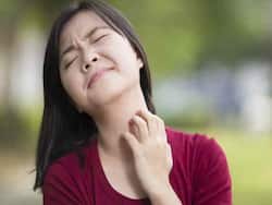 Do You Have Sensitive Skin? Shahnaz Husain Shares Tips To Deal With Allergic Reactions