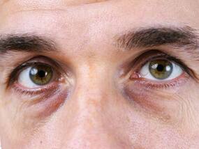 Say Goodbye To Dark Circles, Puffy Eyes: Advantages Of Nanotechnology-Based Eye Serum