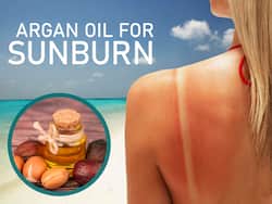 This One Ingredient May Alleviate Sunburn Pain And Heal Your Skin