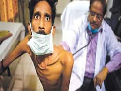 TB Might Hit Covid Patients Post Recovery: Watch Out For The Signs And Symptoms