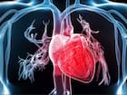 Cardiomyopathy