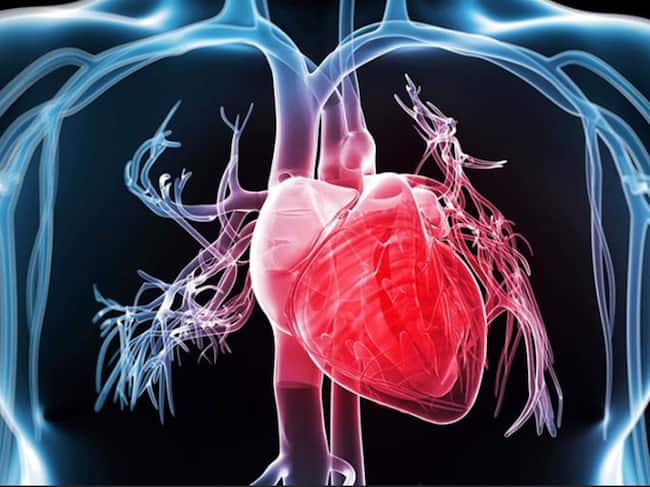 cardiomyopathy-2