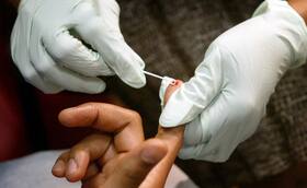 Miracle Combination Treatment For HIV May Reduce The Need For Daily Medication Miracle Combination Treatment For HIV May Reduce The Need For Daily Medication