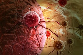 Future Cancer Vaccines May Be Used Along With Traditional Immunotherapy Treatments: Yale Scientists