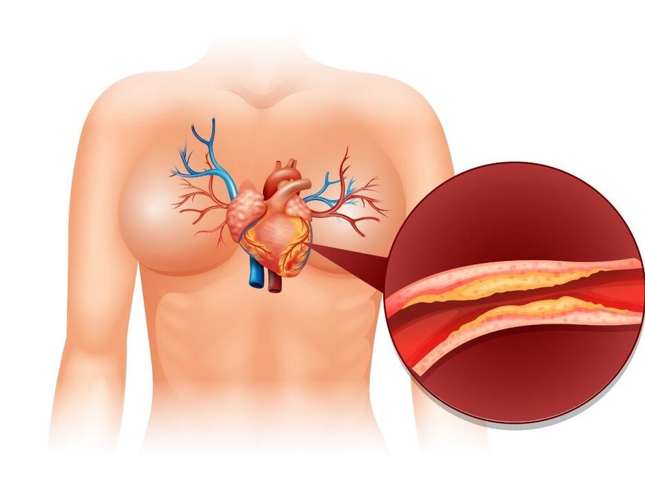 World Heart Day 2021: भारतीयों में बहुत ही कॉमन हैं ये 5 हृदय रोग, जो बनते हैं मौत का कारण; विस्तार से जानिए