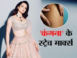 कंगना रनौत को थलाइवी के लिए 20 किलो वजन बढ़ाना पड़ा भारी, एक्ट्रेस ने कहा पड़ गए हैं पेट पर परमानेंट स्ट्रेच मार्क्स
