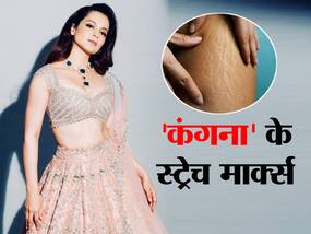 कंगना रनौत को थलाइवी के लिए 20 किलो वजन बढ़ाना पड़ा भारी, एक्ट्रेस ने कहा पड़ गए हैं पेट पर परमानेंट स्ट्रेच मार्क्स