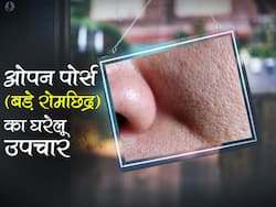Open Pores यानी बड़े रोमछिद्र खराब कर देते हैं आपकी खूबसूरती, इन 5 नुस्खों से पाएं ओपन पोर्स से छुटकारा