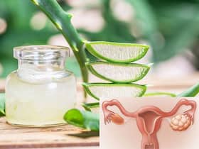 Aloe Vera For PCOS: हर 5 में से एक महिला पीसीओएस की है शिकार, जानिए PCOS में क्यों फायदेमंद है एलोवेरा