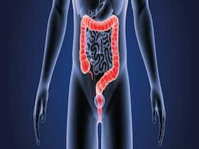 Colorectal Cancer Cases On Rise Among Young Adults In India: Rare and Unusual Symptoms You Need To Know