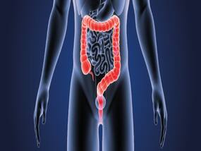 Colorectal Cancer Cases On Rise Among Young Adults In India: Rare and Unusual Symptoms You Need To Know