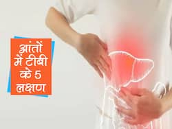 आंतों में छिपी टीबी बहुत तेजी से बिगाड़ती है आपका स्वास्थ्य! इस संकेतों से पहचानें आंतों में छिपी टीबी के लक्षण