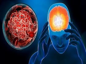 How To Help Brain Stroke Patients With Simple Home Measures?