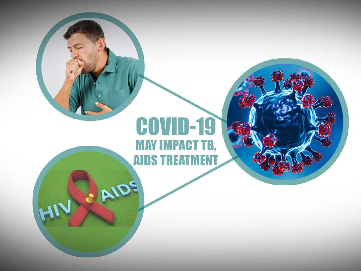 HIV, TB Patients May Suffer From ‘Devastating’ Impact Of Covid-19; Know ...