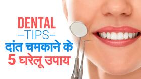 Dental Hygiene: दांतों को चमकाने के उपाय | दांतो का पीलापन दुर करने के घरेलू उपाय Dental Hygiene: दांतों को चमकाने के उपाय | दांतो का पीलापन दुर करने के घरेलू उपाय