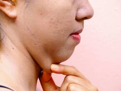Exercise for double chin in hindi : लटकती हुई ठोड़ी को अंदर करेंगी ये 5 फेशियल एक्सरसाइज