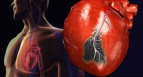 रिस्‍क स्‍कोर से पता चल सकता है हार्ट अटैक का कितना रिस्‍क है, डॉक्‍टर से जानिए हार्ट अटैक आने पर तुरंत क्‍या करें