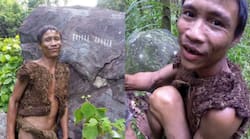 Real Life Tarzan    Succumbs To Liver Cancer After 41 Years of Jungle Life: How Unhealthy Diet Can Damage Your Liver