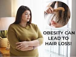 Lose Weight Before Its Too Late; Obesity Can Lead To Hair Thinning, Loss