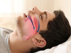 Obstructive Sleep Apnoea And Type 2 Diabetes: A Dangerous Combination That Ups Your Risk Of CVD