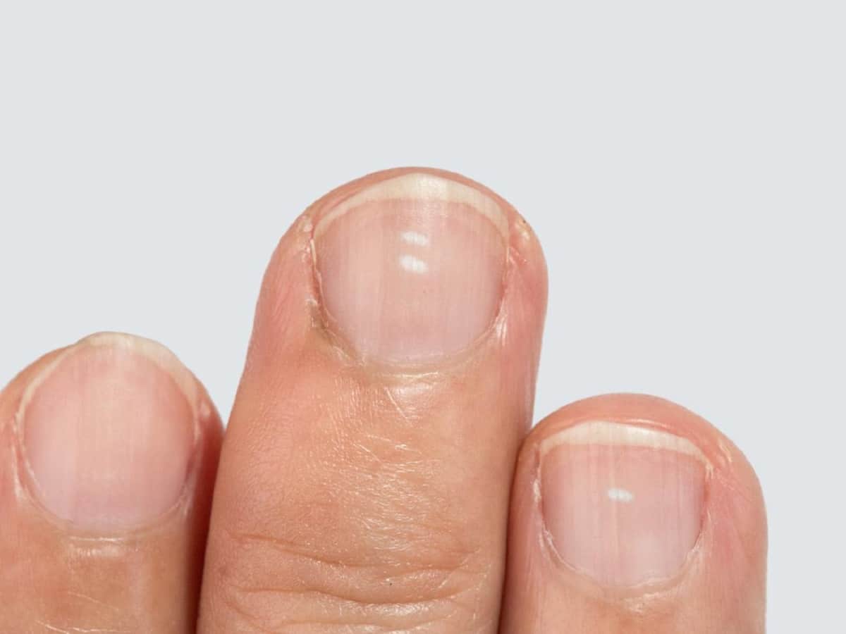 If Your Nails Are Breaking, You Could Be Lacking This Nutrient