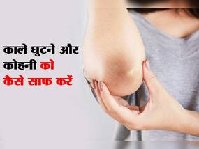 Home Remedies For Dark Elbow: डार्क कोहनी और घुटनों की त्वचा से राहत के घरेलू उपाय