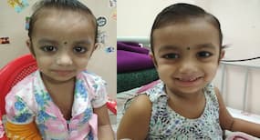 Dinutuximab Immunotherapy For Neuroblastoma: All You Need To Know About This Antibody Therapy