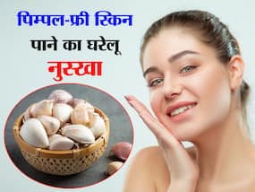 Tips to get rid of pimples quickly : रातोंरात पिम्पल्स ठीक करने के उपाय