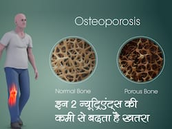 рдЗрди 2 рдиреНрдпреВрдЯреНрд░рд┐рдПрдВрдЯреНрд╕ рдХрд╛ рд╕реЗрд╡рди рдЖрдкрдХреЛ рдСрд╕реНрдЯрд┐рдпреЛрдкреЛрд░реЛрд╕рд┐рд╕ рд╕реЗ рдмрдЪрд╛рдиреЗ рдореЗрдВ рдХрд░ рд╕рдХрддрд╛ рд╣реИ рдорджрдж, рдПрдХреНрд╕рдкрд░реНрдЯ рд╕реЗ рдЬрд╛рдиреЗрдВ рдХрд┐рди рд▓реЛрдЧреЛрдВ рдХреЗ рд▓рд┐рдП рд╣реИ рдмреЗрд╣рдж рдЬрд░реВрд░реА