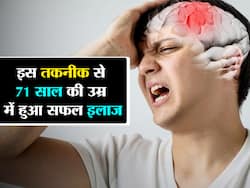 71 साल की महिला के दिमाग की नस में बने थक्के को इस सर्जरी से निकाला बाहर, हफ्ते भर में ठीक हुई महिला
