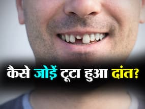टूटे हए दांत को खुद कैसे जोड़ें? जानें कितनी देर तक खुद जोड़ सकते हैं अपना टूटा हुआ दांत