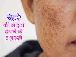 नाभि में नीम का तेल डालने से चेहरे की झाइयां हो जाती हैं गायब, जानें झाइयों को गायब करने के 5 आसान उपाय