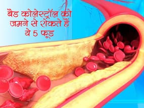 कोलेस्ट्रॉल की समस्या से मिलेगी निजात डाइट में शामिल करें ये 5 फूड्स