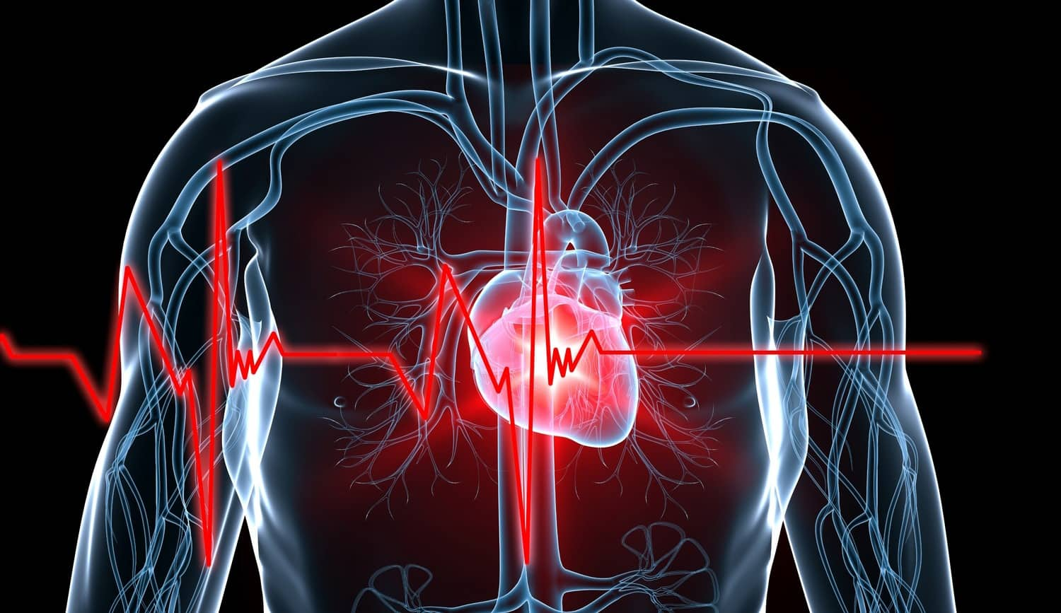 Sudden Cardiac Arrest: What Precautions Should A Heart Patient With ...