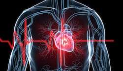 Sudden Cardiac Arrest: What Precautions Should A Heart Patient With Existing Heart Conditions Take?