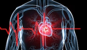 Sudden Cardiac Arrest: What Precautions Should A Heart Patient With Existing Heart Conditions Take? Sudden Cardiac Arrest: What Precautions Should A Heart Patient With Existing Heart Conditions Take?