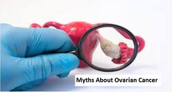 Myths About Ovarian Cancer: Cysts Usually Develop Into Cancer