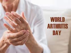 World Arthritis Day 2021: Common Arthritis Treatments You Should Know About