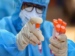 देश के 6 राज्‍यों में फैल चुका है कोरोना का सबसे खतरनाक AY.4.2 स्‍ट्रेन, करीब 17 सैंपलों में मिला वेरिएंट